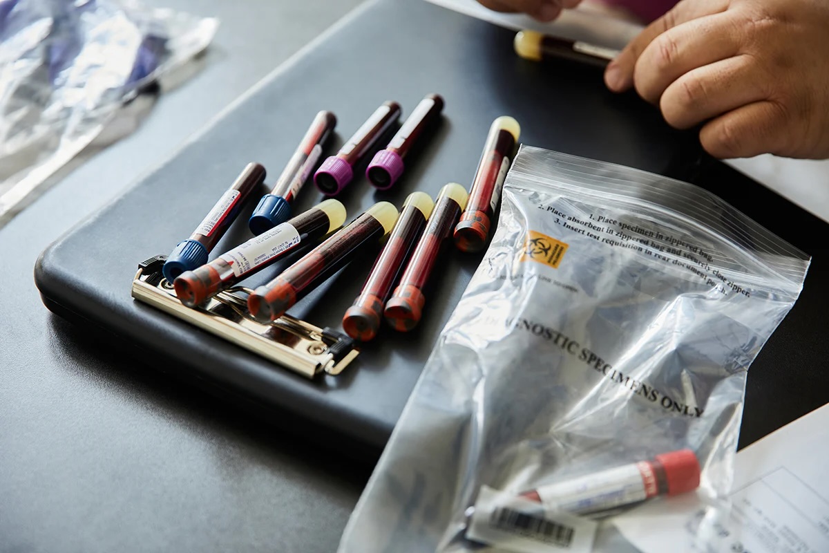 Blood sample vials ready for lab analysis